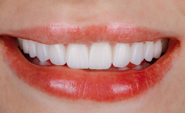 Final appearance after cosmetic treatment