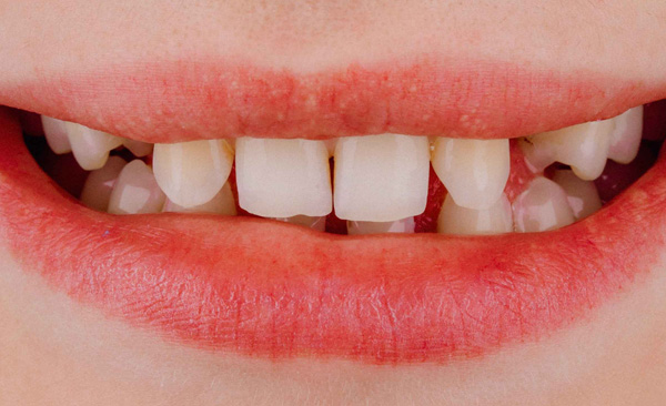 Patient appearance before cosmetic procedure