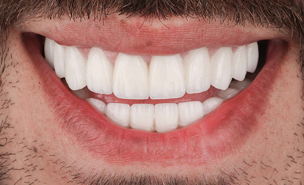 Cosmetic treatment after procedure result