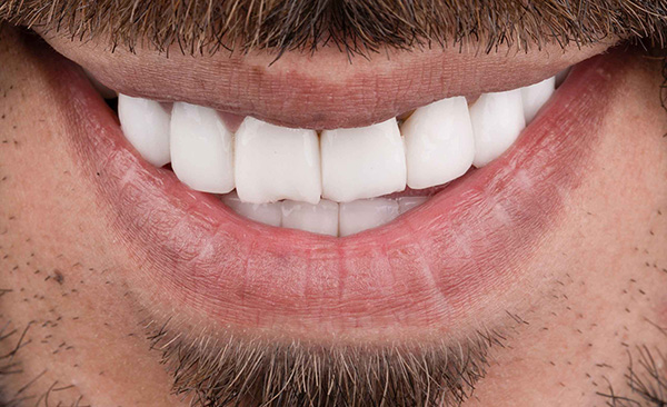 Before image of cosmetic aesthetic treatment