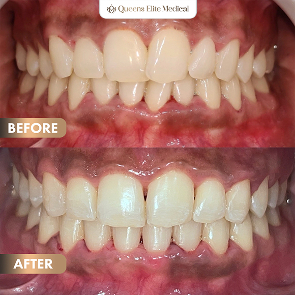 2BeforeAfter