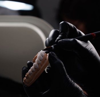 Stain-resistant dental veneer material used at Queens Elite