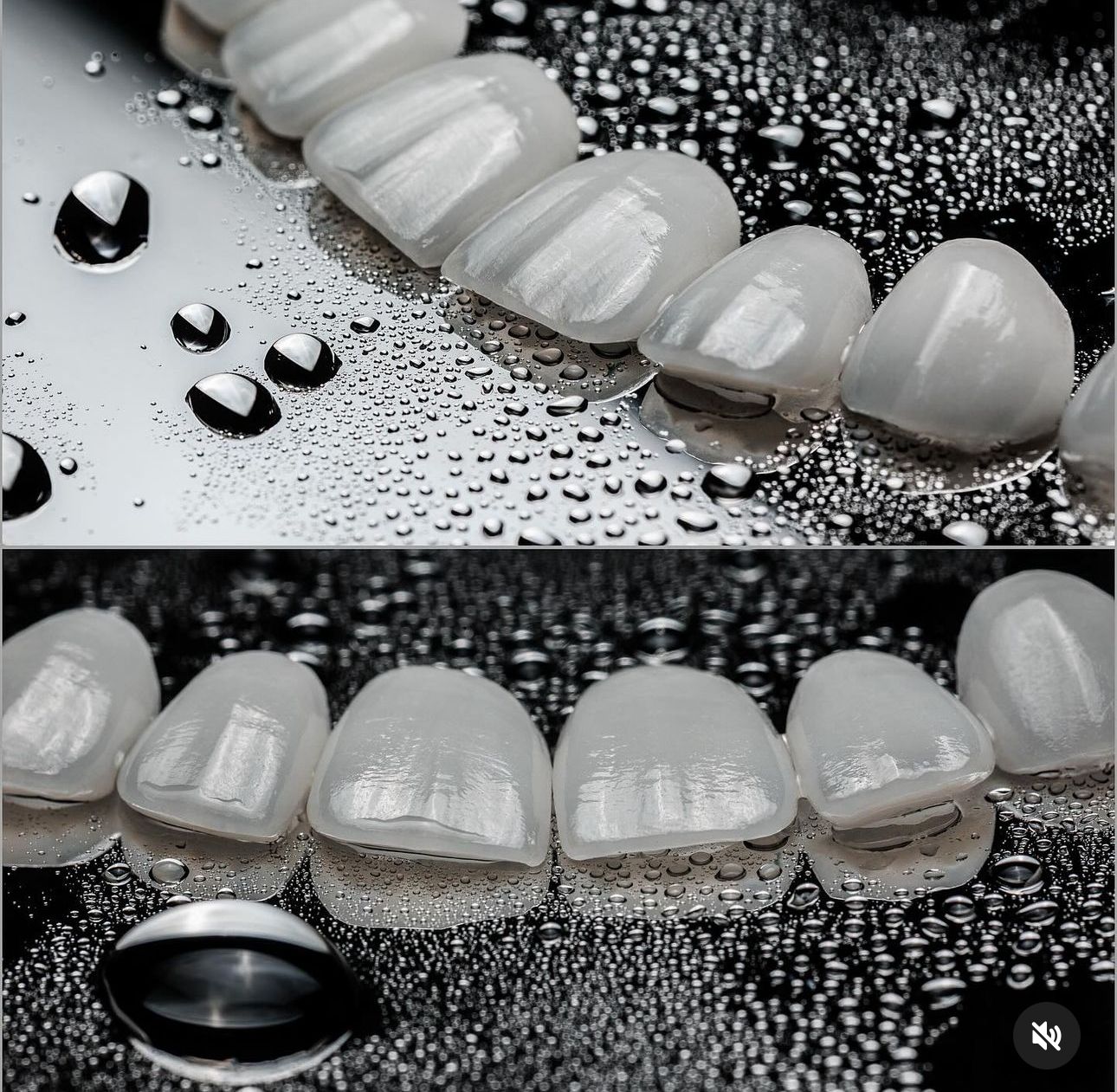 Ultra-thin and durable dental veneer material