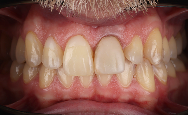 Initial condition before cosmetic enhancement