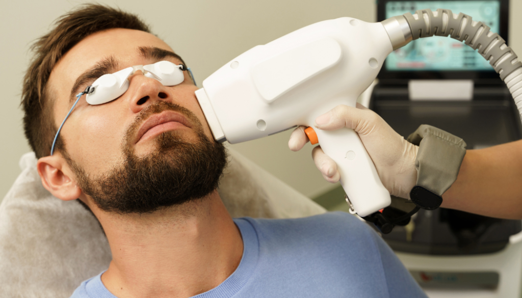 Laser Beard Shaping Dubai