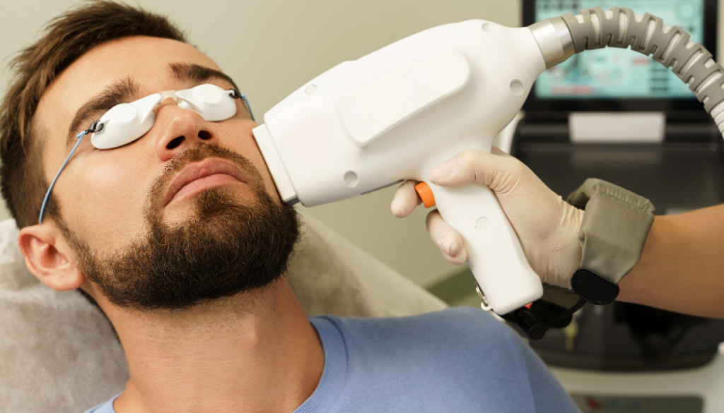 Laser Beard Shaping